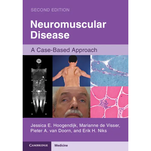 Neuromuscular Disease: A Case-Based Approach - Paperback