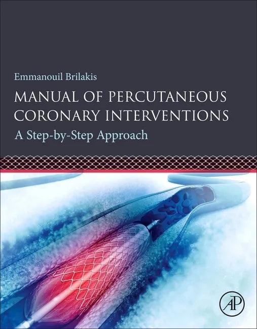 Manual of Percutaneous Coronary Interventions: A Step-By-Step Approach - Paperback