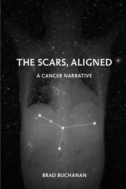 The Scars, Aligned - Paperback