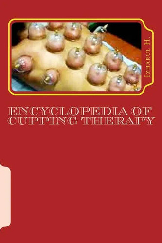 Encyclopedia of Cupping Therapy: Al-Hijama - Paperback