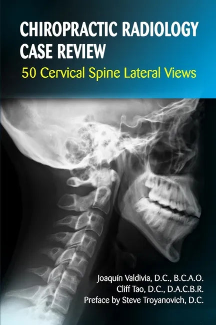 Chiropractic Radiology Case Review: 50 Cervical Spine Lateral Views - Paperback
