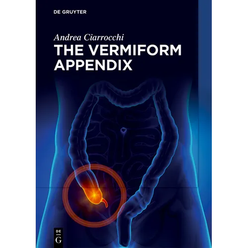 The Vermiform Appendix - Hardcover