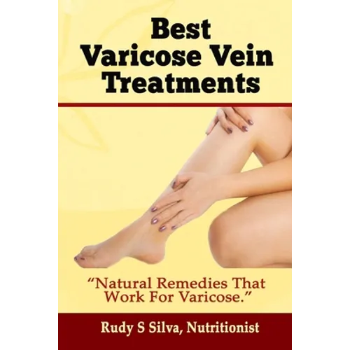 Best Varicose Vein Treatments: Natural Remedies That Work for Varicose - Paperback