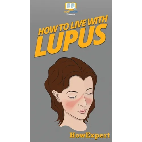 How To Live With Lupus: Your Step By Step Guide To Living With Lupus - Hardcover