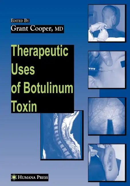 Therapeutic Uses of Botulinum Toxin - Paperback