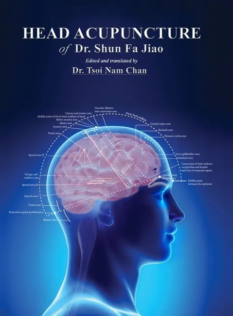 Head Acupuncture of Dr. Shun Fa Jiao - Hardcover