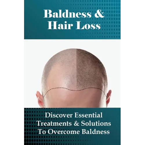 Baldness & Hair Loss: Discover Essential Treatments & Solutions To Overcome Baldness: How To Prevent Hair Loss For Guys - Paperback