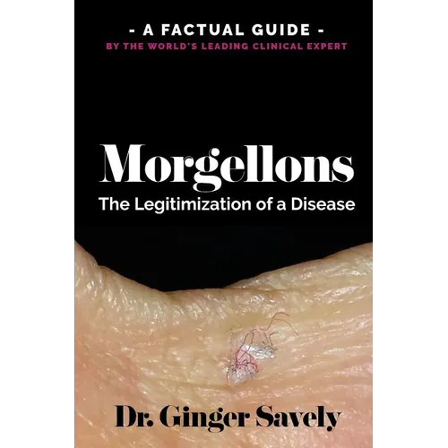 Morgellons: The legitimization of a disease: A Factual Guide by the World's Leading Clinical Expert - Paperback