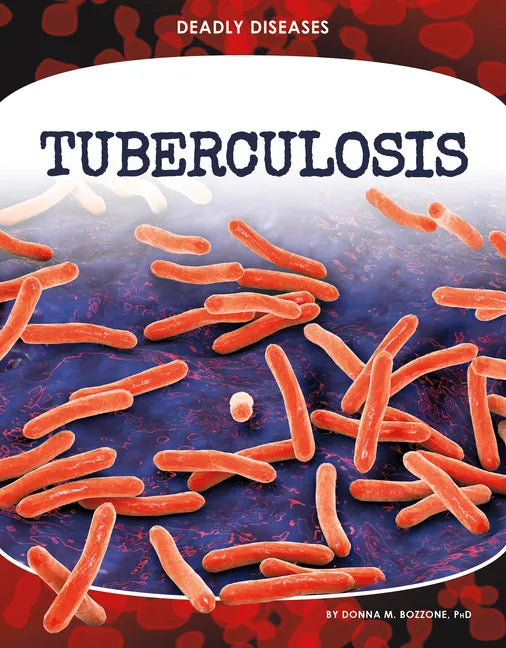 Tuberculosis - Library Binding
