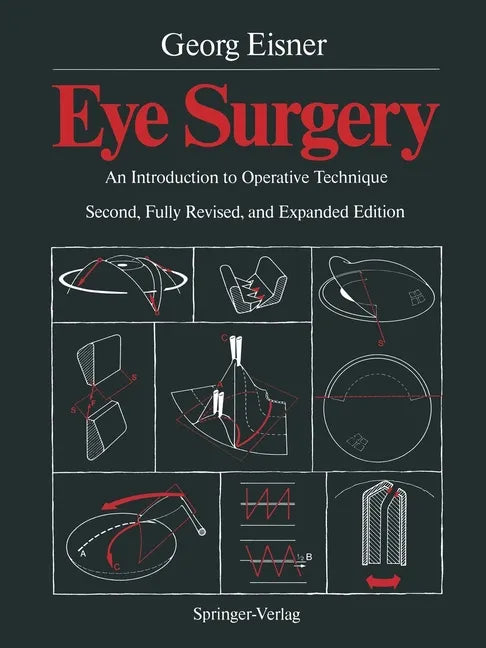 Eye Surgery: An Introduction to Operative Technique - Paperback