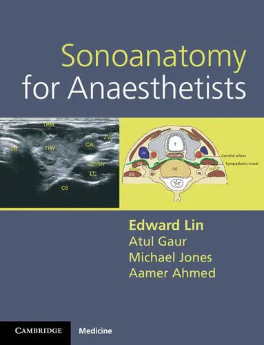 Sonoanatomy for Anaesthetists - Spiral