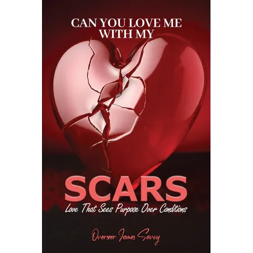 Can You Love Me With My Scars - Paperback
