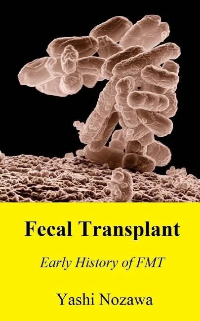 Fecal Transplant: Early History of FMT - Paperback