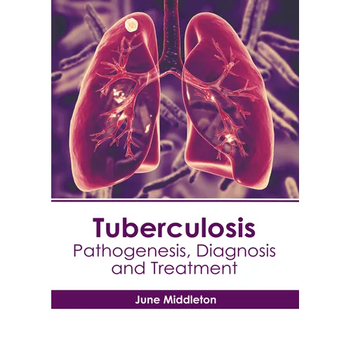 Tuberculosis: Pathogenesis, Diagnosis and Treatment - Hardcover