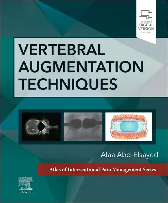 Vertebral Augmentation Techniques - Hardcover