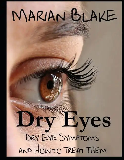Dry Eyes (Large Print): Dry Eye Symptoms and how to treat them - Paperback
