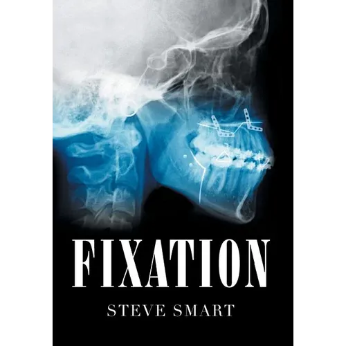 Fixation - Hardcover