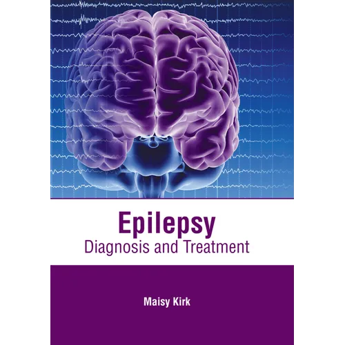 Epilepsy: Diagnosis and Treatment - Hardcover
