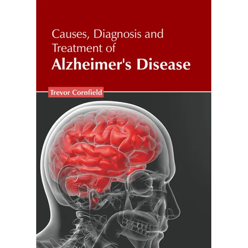 Causes, Diagnosis and Treatment of Alzheimer's Disease - Hardcover