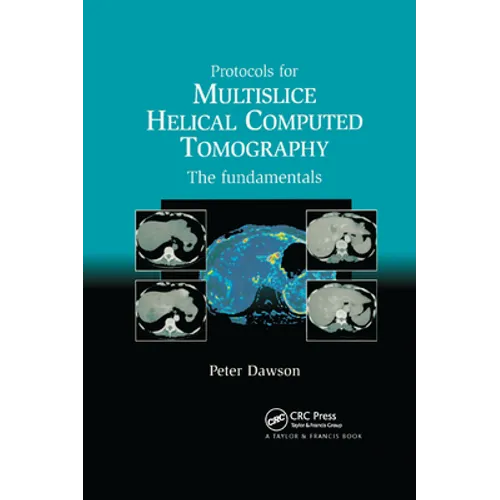 Protocols for Multislice Helical Computed Tomography: The Fundamentals - Paperback