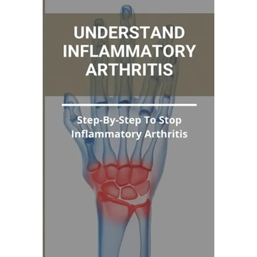 Understand Inflammatory Arthritis: Step-By-Step To Stop Inflammatory Arthritis: Unusual Symptoms Of Rheumatoid Arthritis - Paperback