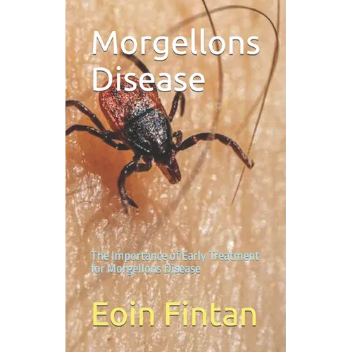Morgellons Disease: The Importance of Early Treatment for Morgellons Disease - Paperback