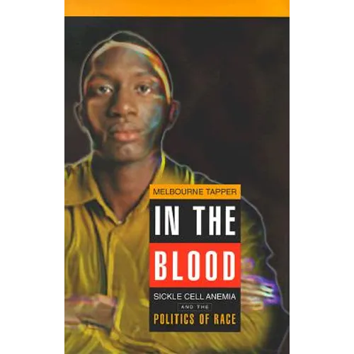 In the Blood: Sickle Cell Anemia and the Politics of Race - Hardcover