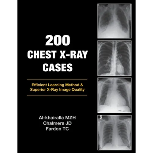 200 Chest X-Ray Cases - Paperback