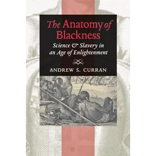 The Anatomy of Blackness: Science & Slavery in an Age of Enlightenment - Paperback
