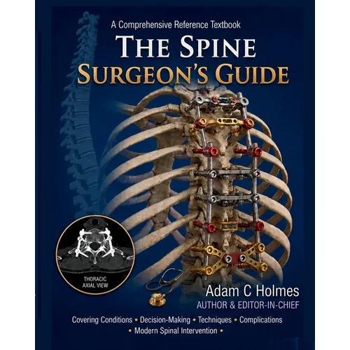 The Spine Surgeon's Guide: A Comprehensive Reference Textbook Covering Spine Conditions, Surgical Decision- Making, Operative Techniques, Complication - Paperback
