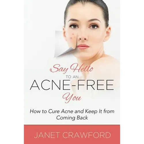 Say Hello to an Acne-Free You: How to Cure Acne and Keep It from Coming Back - Paperback
