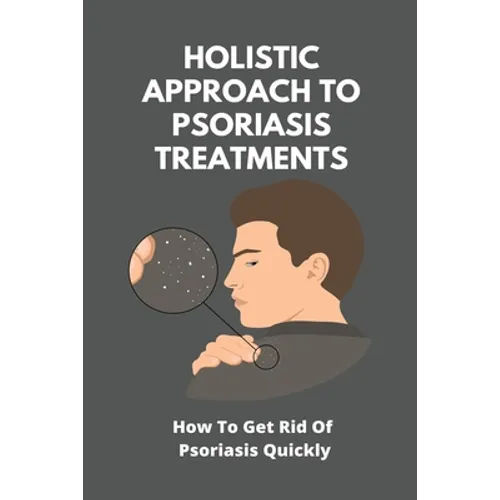 Holistic Approach To Psoriasis Treatments: How To Get Rid Of Psoriasis Quickly: Is Psoriasis Itchy - Paperback