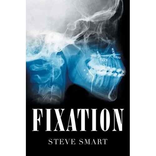 Fixation - Paperback