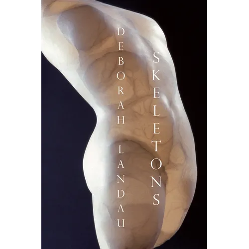 Skeletons - Paperback