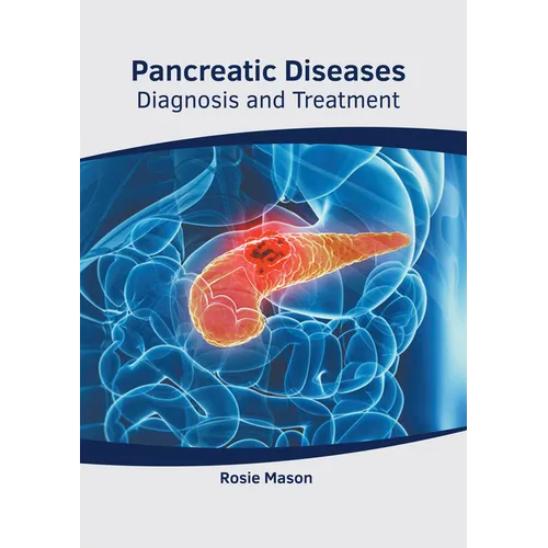 Pancreatic Diseases: Diagnosis and Treatment - Hardcover