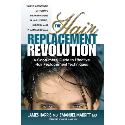 The Hair Replacement Revolution: A Consumer's Guide to Effective Hair Replacement Techniques - Paperback