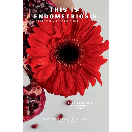 This Is Endometriosis - Paperback