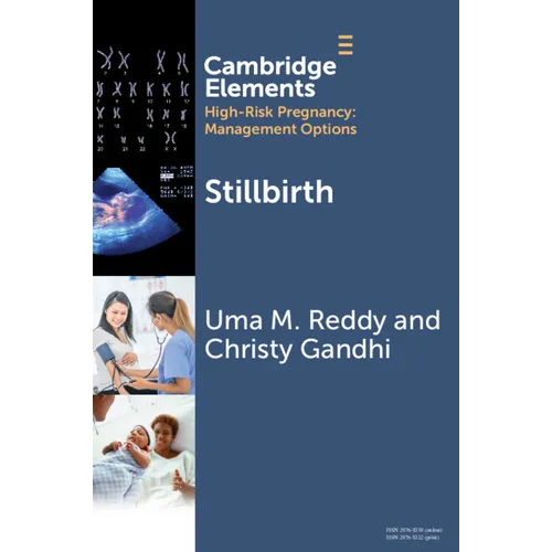 Stillbirth - Paperback
