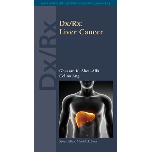 DX/Rx: Liver Cancer: . - Paperback