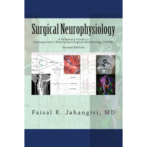Surgical Neurophysiology - 2nd Edition: A Reference Guide to Intraoperative Neurophysiological Monitoring - Paperback