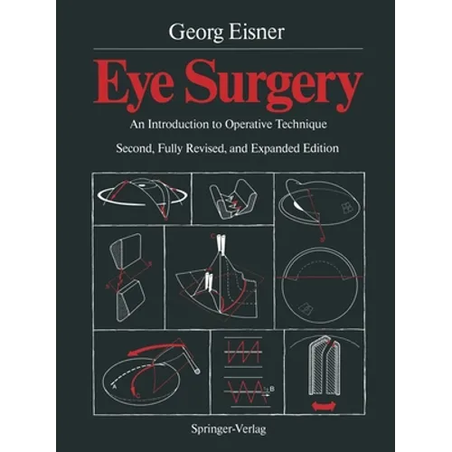 Eye Surgery: An Introduction to Operative Technique - Paperback