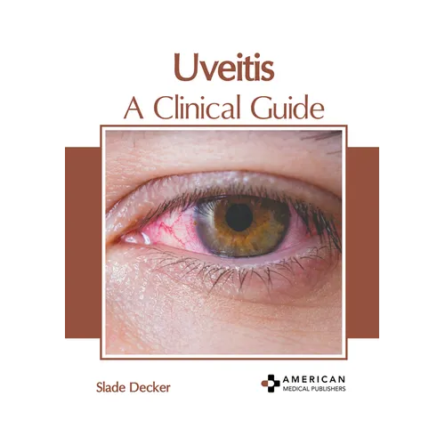 Uveitis: A Clinical Guide - Hardcover