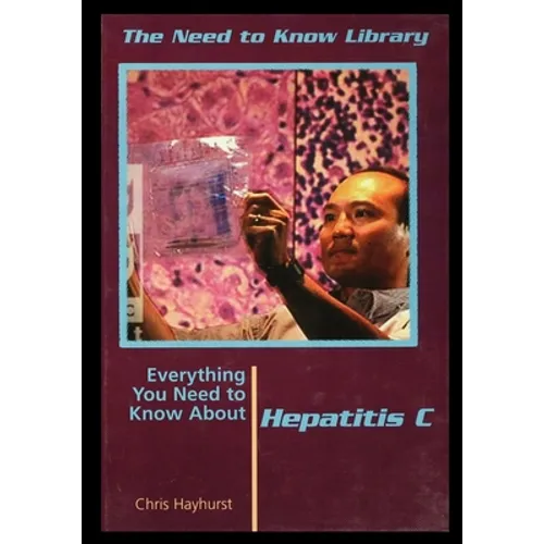 Hepatitis C - Paperback