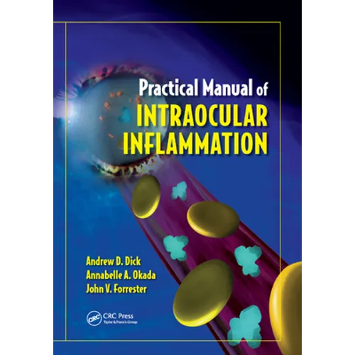 Practical Manual of Intraocular Inflammation - Paperback
