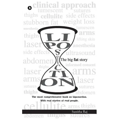 Liposuction - The Big Fat Story - Paperback