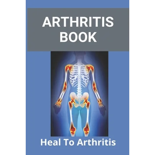 Arthritis Book: Heal To Arthritis: Rheumatoid Arthritis Treatment - Paperback