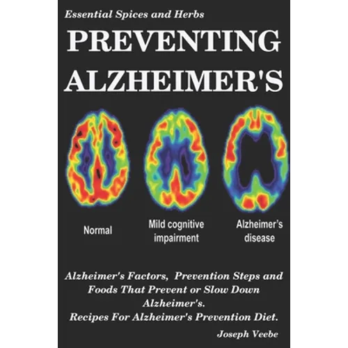 Preventing Alzheimer's: Alzheimer's Factors, Prevention Steps and Foods That Prevent or Slow Alzheimer's, Recipes for Alzheimer's Prevention Diet - Paperback